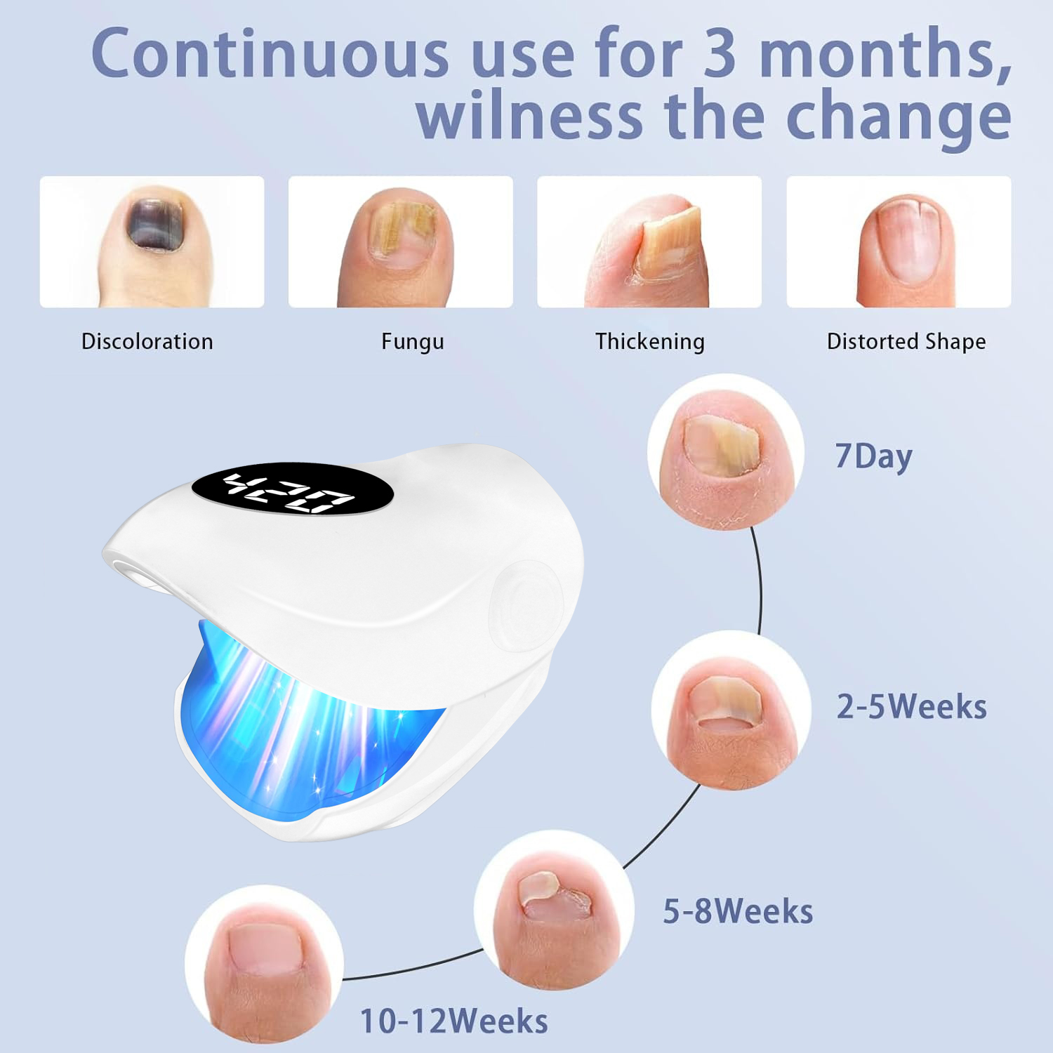 USB Charging Nail Fungus Treat - Galvanic Skin Sensor recension och pris